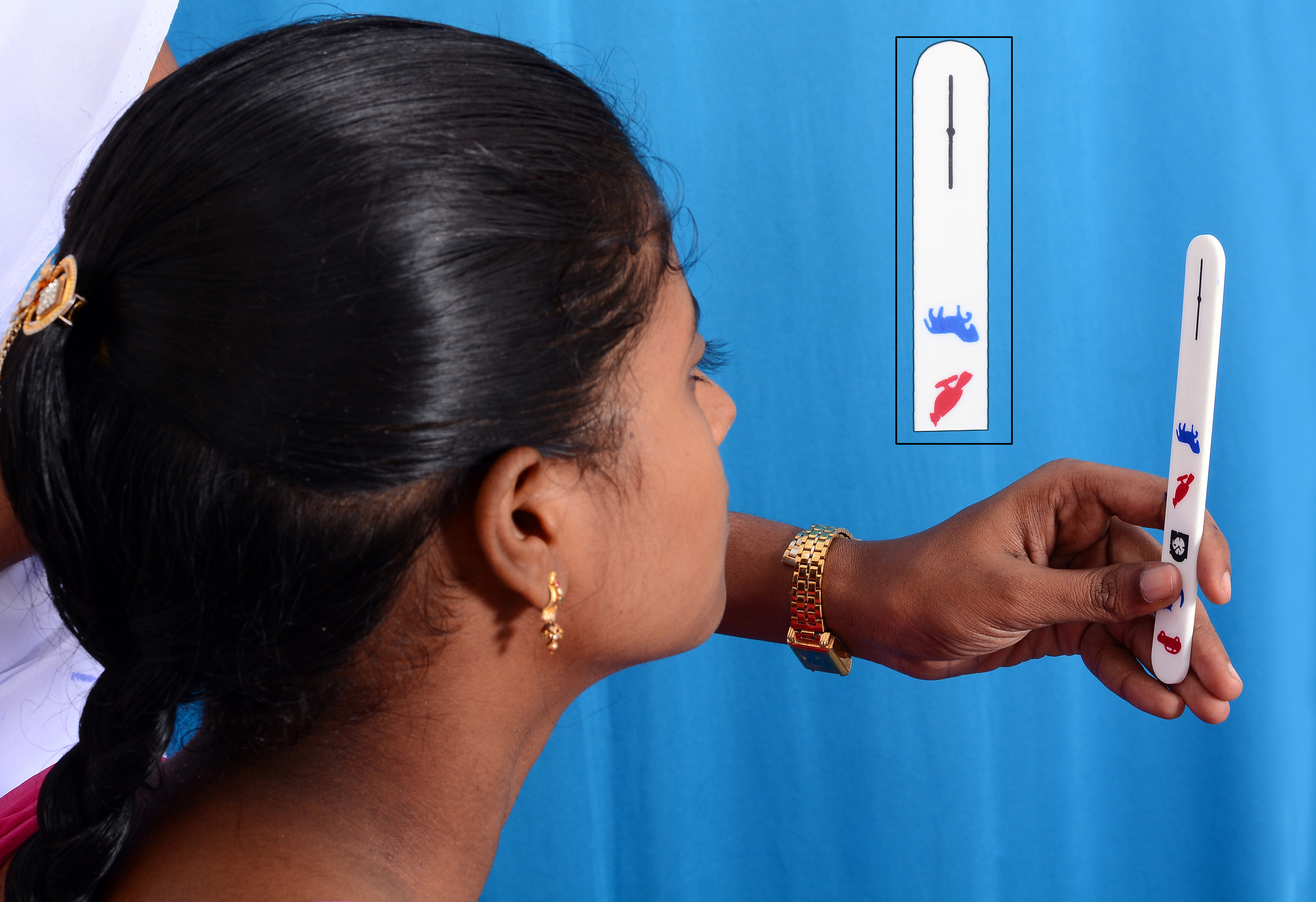 Examination of convergence. INDIA. (c) DR. P. VIJAYALAKSHMI/ ARAVIND EYE HOSPITAL