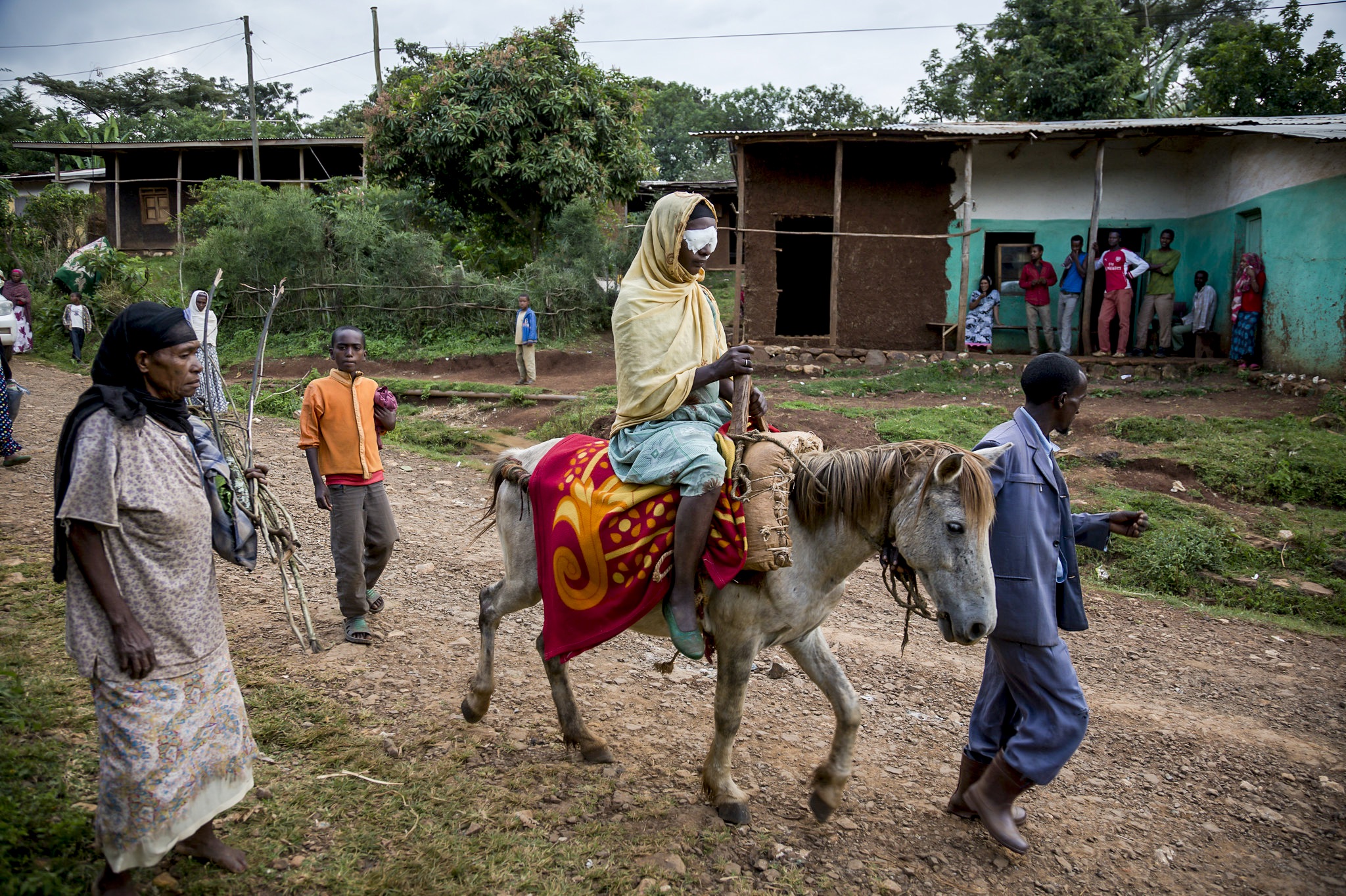 Trachoma