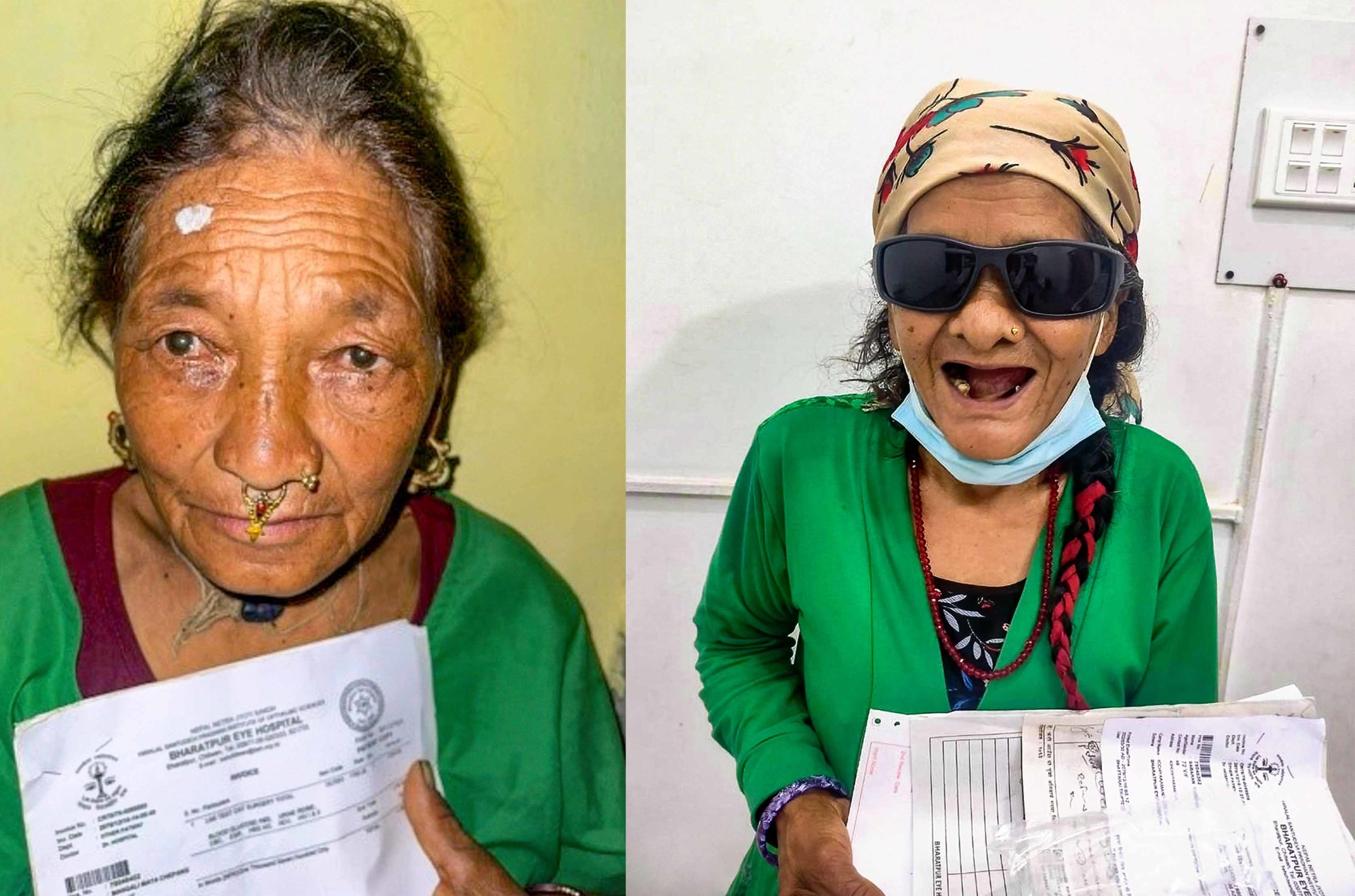 (Left) A Chepang woman before surgery at the base hospital. NEPAL (Right) A happy Chepang woman after cataract surgery. NEPAL (Photo:  Ashma KC CC BY-NC 4.0)