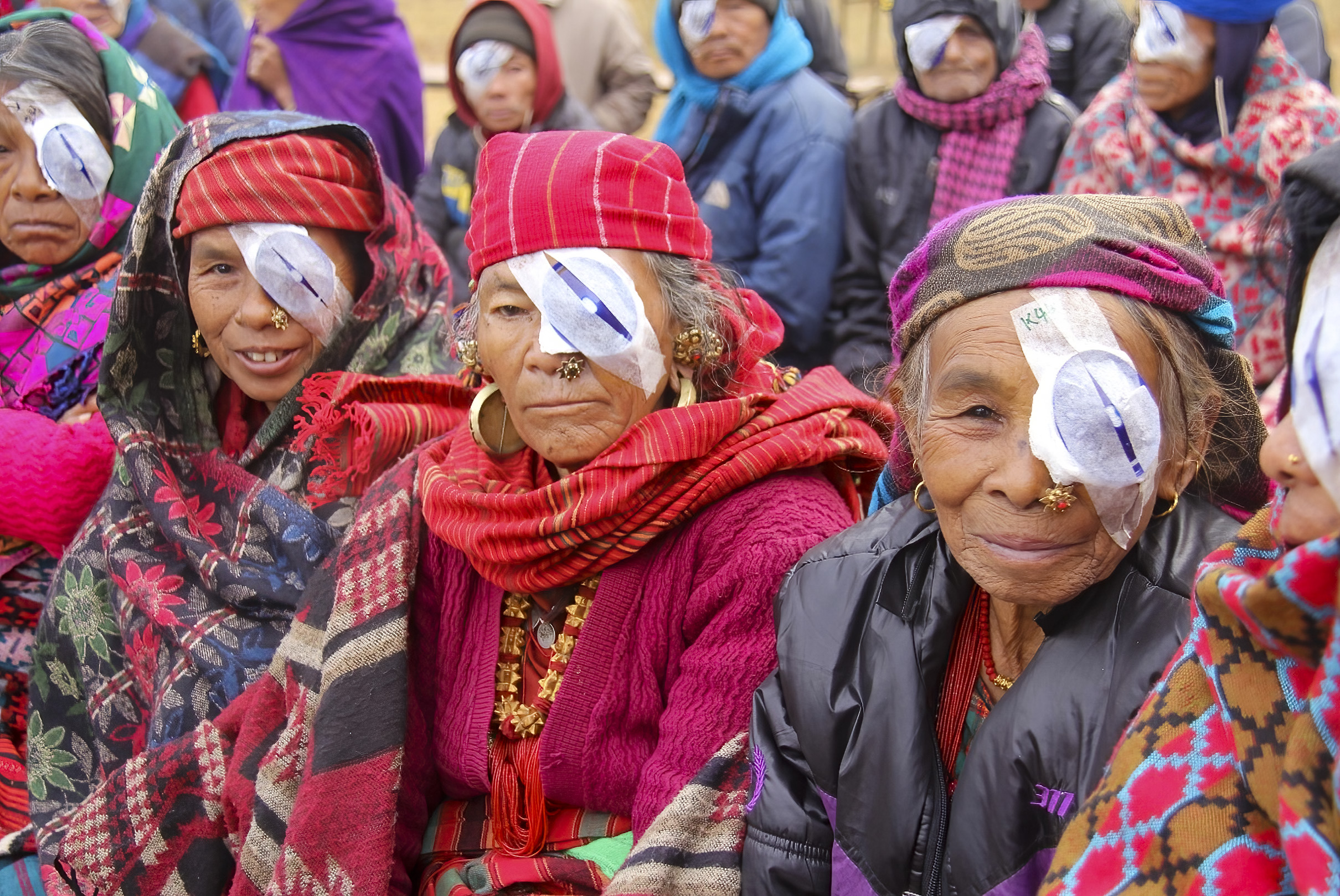 Women in Nepal bear a greater burden of blindness than men, but are less able to access the eye care they need, Nepal. (Photo: Sunita KC CC BY-NC-SA 4.0)