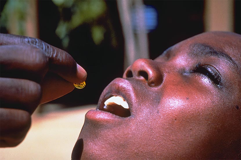 Giving vitamin A to a child. TANZANIA