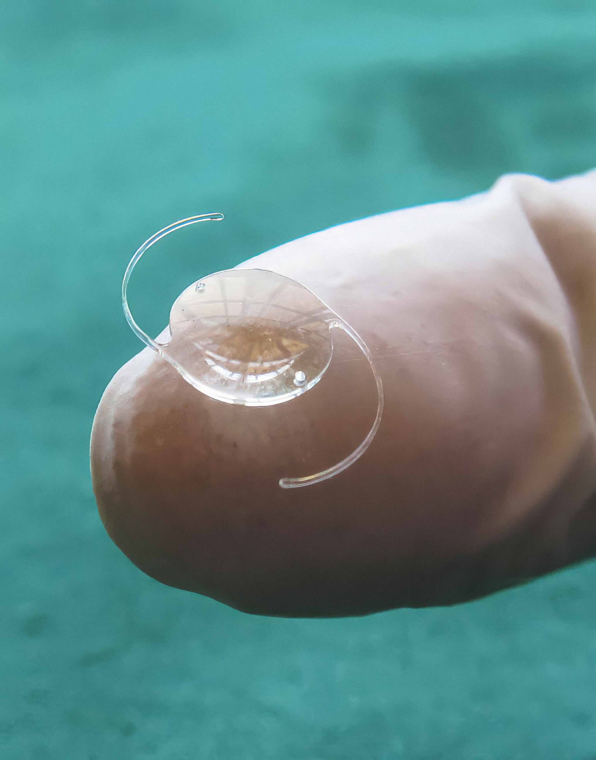 It is vital to have the correct IOL available. (Photo: © Heiko Philippin. CC BY-NC-SA 4.0)