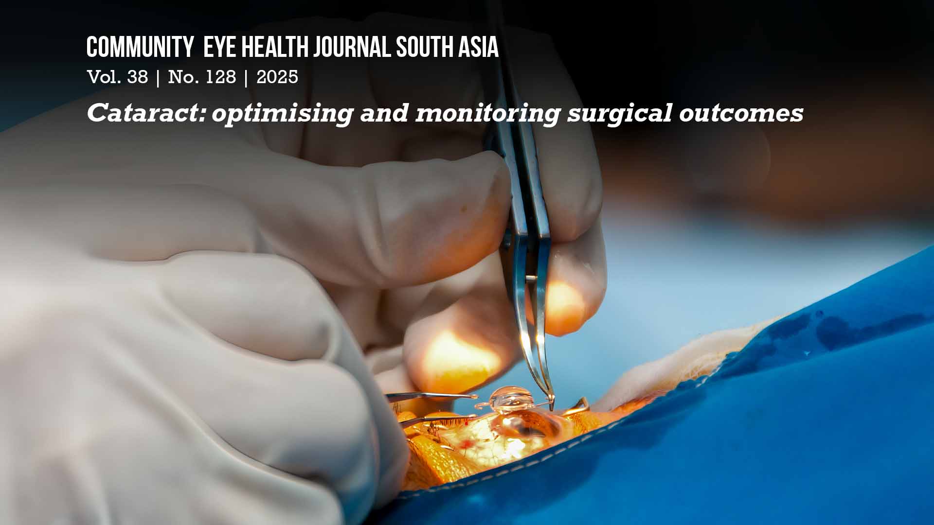 Preparing to insert an intraocular lens during cataract surgery. INDONESIA (Photo: I Wayan Helmy Giana, The John Fawcett Foundation, courtesy of IAPB CC BY-NC-SA 4.0)